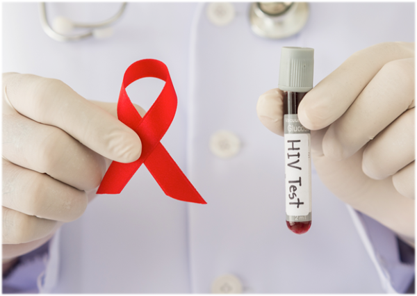 В Арцизе анонимно и бесплатно можно пройти тест на ВИЧ/СПИД