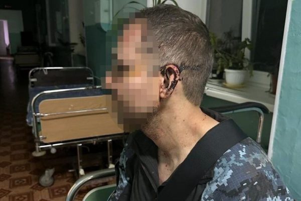 В одній із військових частин Одещини жорстоко побили бійця